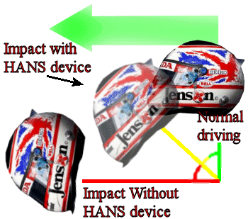 Hans head and neck support hotsell