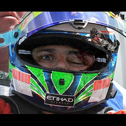 Felipe Massa after crash during 2009 Hungarian Gp